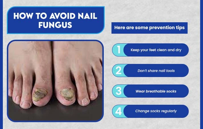onychomycosis icd 10 | A Guide to Nail Fungus and ICD-10 4 How to Avoid Nail Fungus